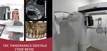Tac Dentale Cone Beam